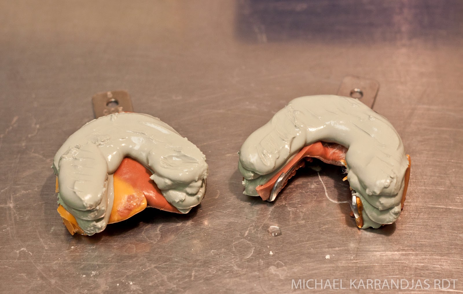 Dental Lab Model Pouring Making Noise And Drinking Beer