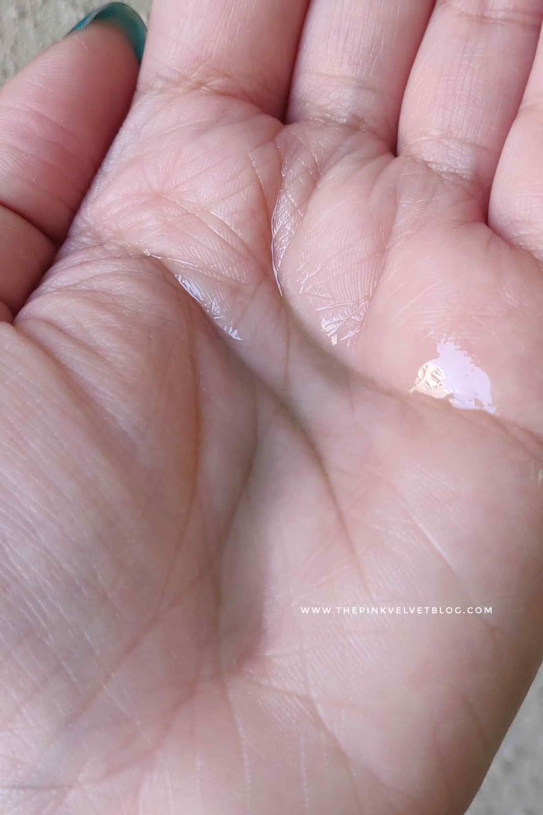 YBP Plant Remedy - A Review by a Sensitive and Acne-Prone Skin Girl 11 YBP Plant Remedy - A Review by a Sensitive and Acne-Prone Skin Girl