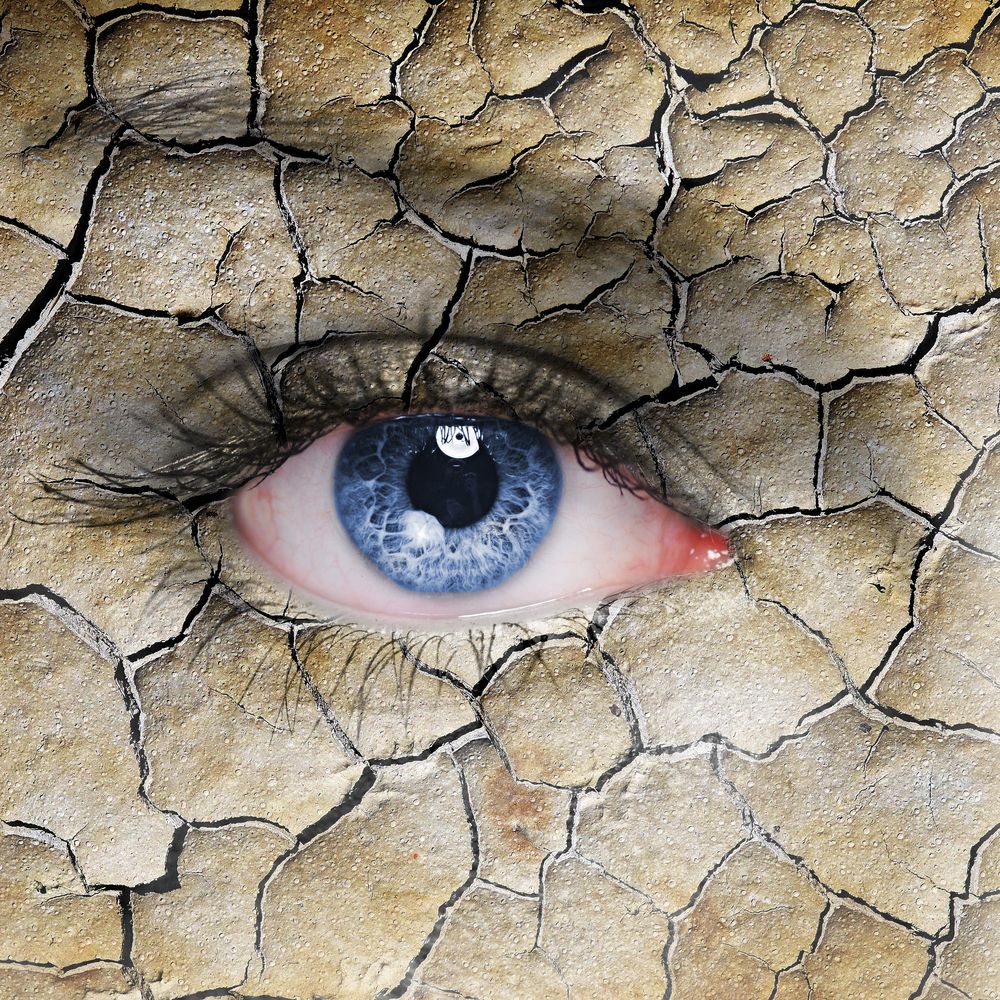 Dry Eye Blog from the experts at The Dry Eye Centre Do I have Dry Eye