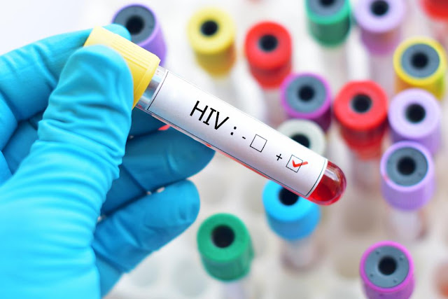 Selain Hubungan Seks, Ini 1 Hal yang Tak Orang Duga Bisa Tularkan Virus Hiv