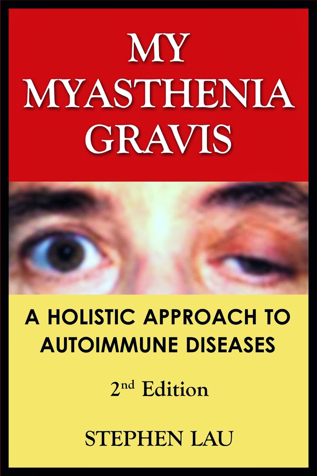 <b>MY MYASTHENIA GRAVIS</b>