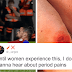 People Shut Down Man Who Told Women To Stop Complaining About Their Period Pain If They Don't Know What A Scraped Knee Pain Feels Like