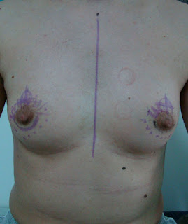 Appearance before surgery