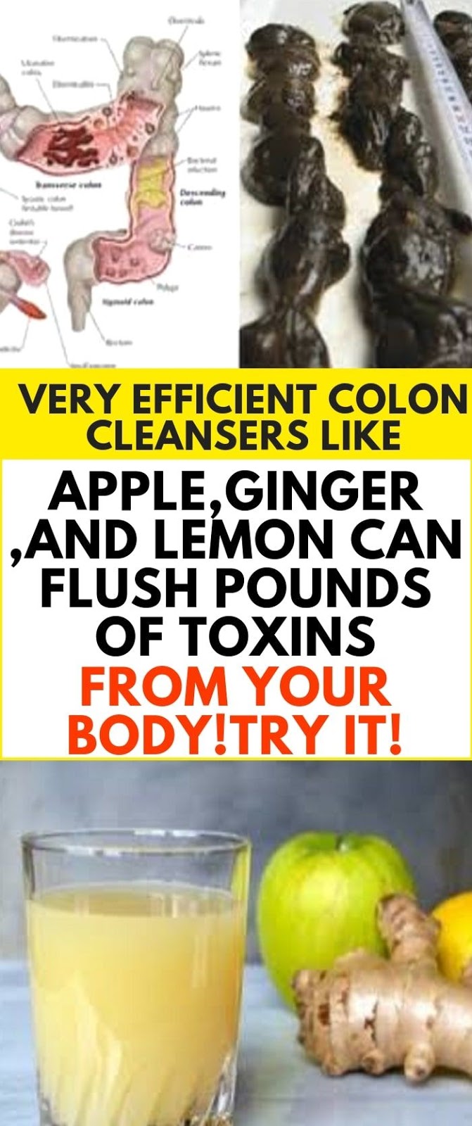 Apple, Ginger And Lemon Makes the Most Powerful Colon Cleanser, It’ll