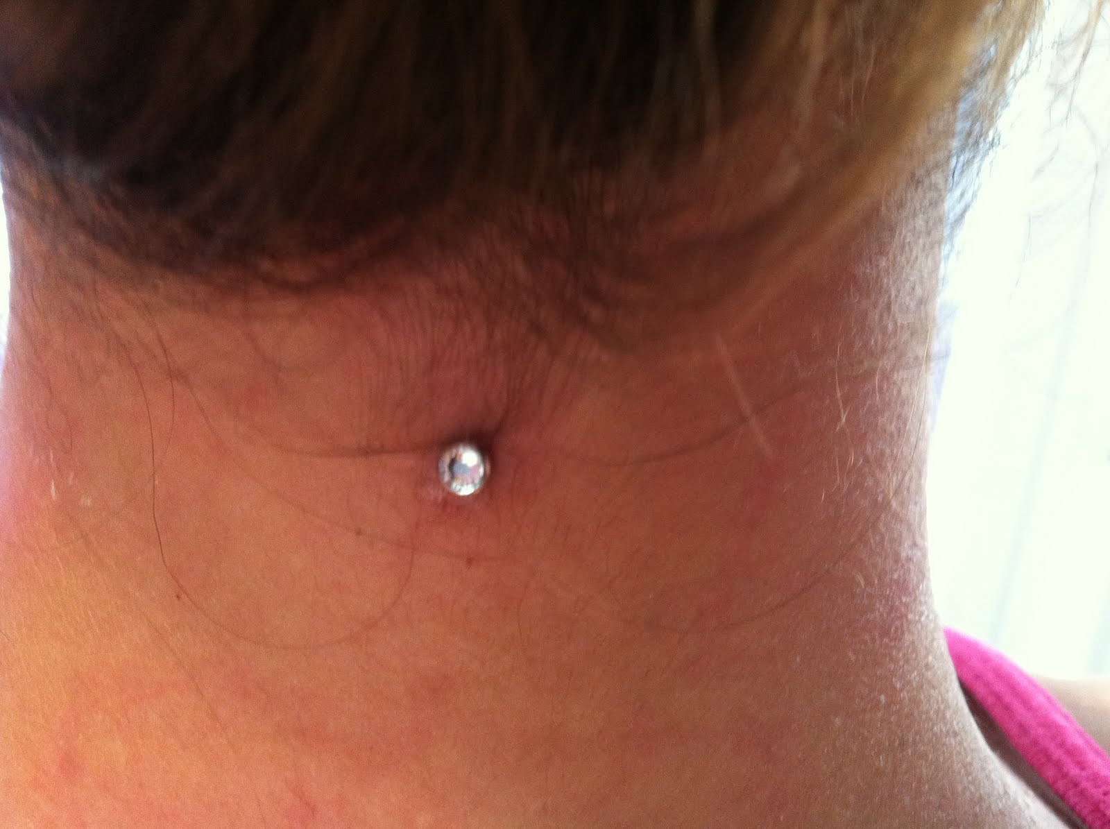 Julie quot supernova quot Highland: Dermal Anchor