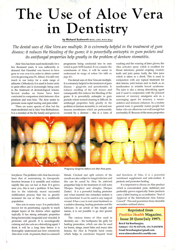 Rwebangira Blog Why you should use Aloe Vera Tooth gel,