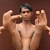 12-year-old boy born with giant hands called a “devil” by villagers