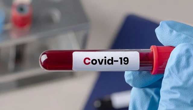 Reportan primer caso de reinfección por Covid-19 en Perú