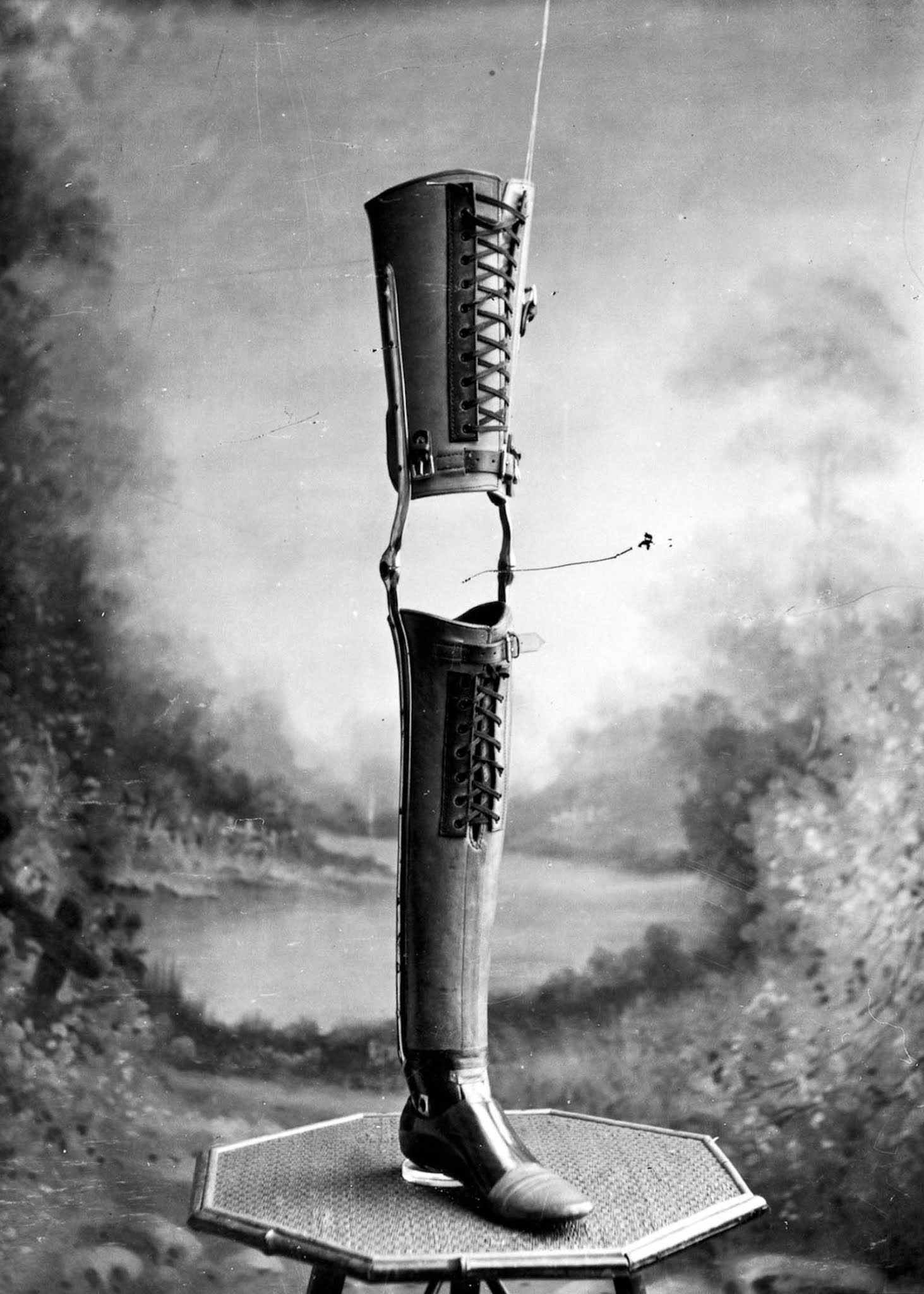 The extraordinary early prostheses made by James Gillingham, 1900
