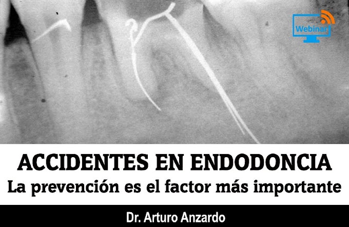 WEBINAR: Accidentes en Endodoncia - Dr. Arturo Anzardo