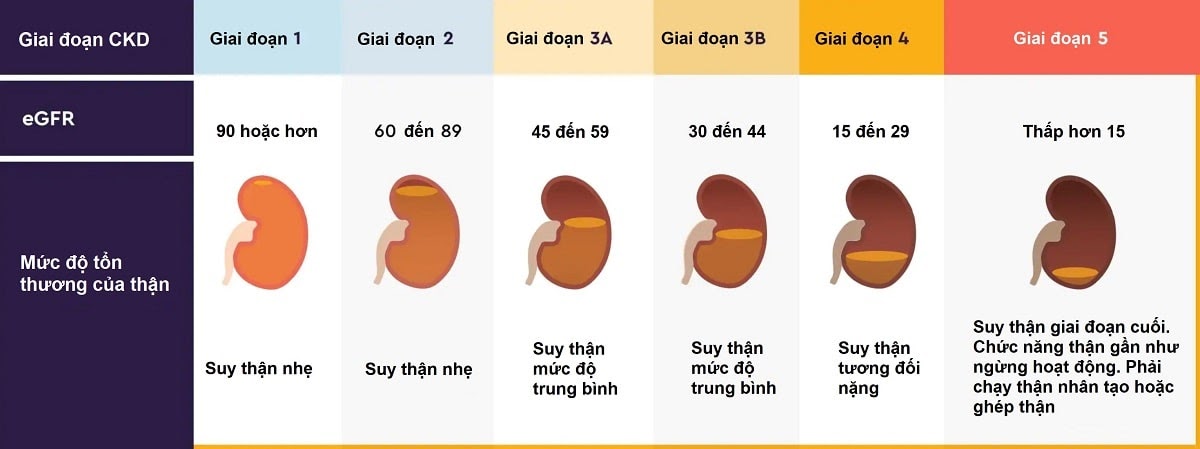 Suy Thận Mạn Tính: Hiểu Rõ 5 Giai Đoạn và Cách Bảo Vệ Thận
