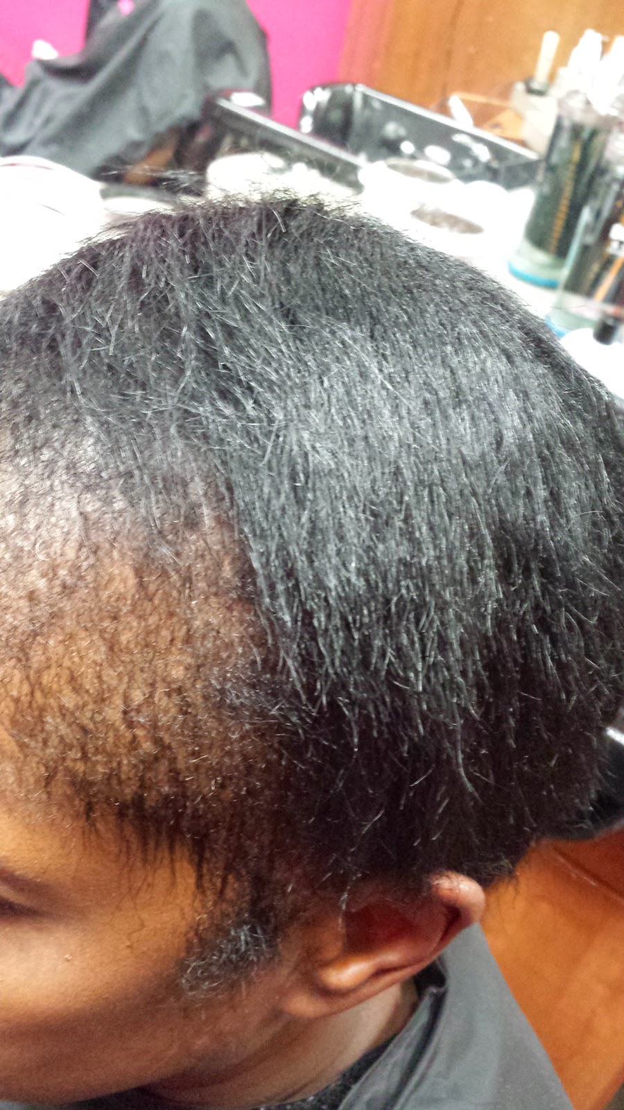 Natural Hair And Scalp Treatment Natural Hair And Scalp Treatment