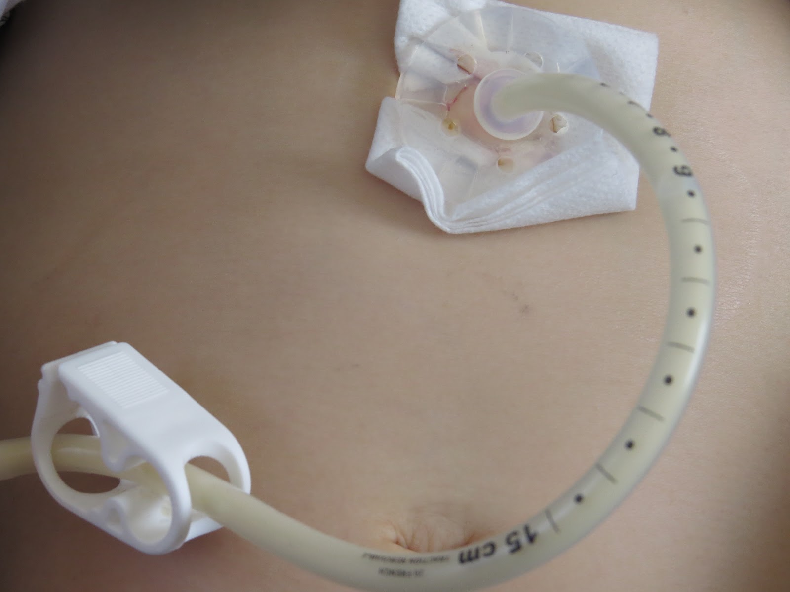 4 lizards and a ladybug peg tube