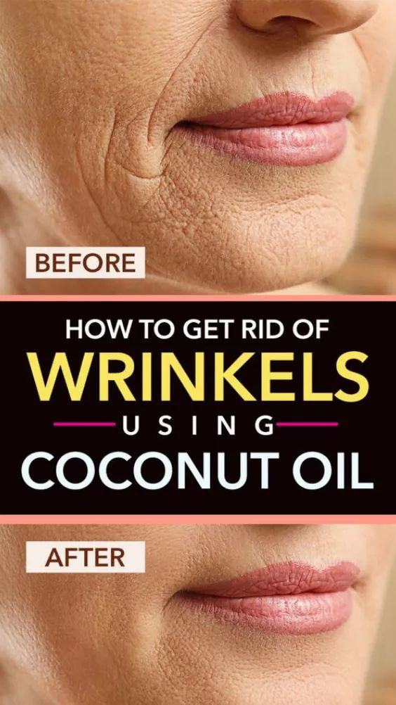 How To Get Rid Of Wrinkles Using Coconut Oil Sweet Oh Joy