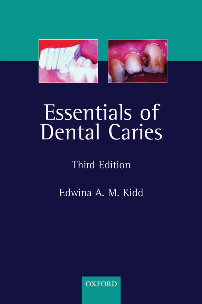 Essentials of Dental Caries 3rd Edition PDF Lobby