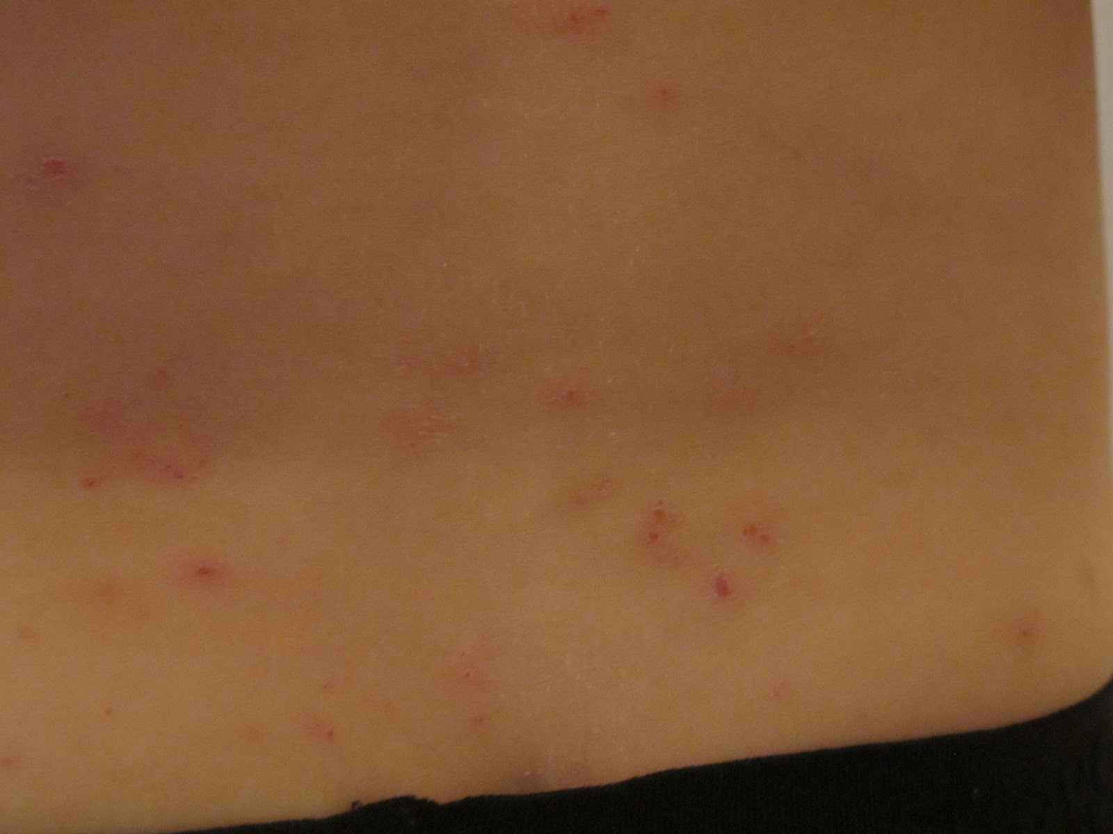 My life...living loving & blogging about it! BED BUGS at The Great