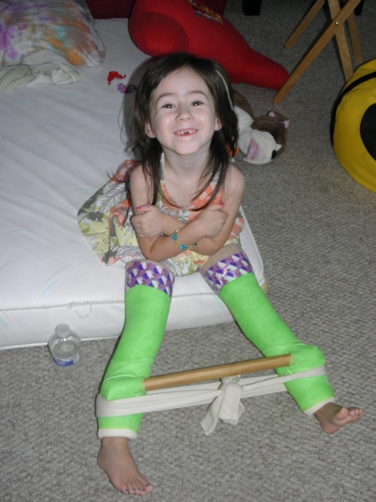 Ava�s Hip Dysplasia Journey I See the Light!