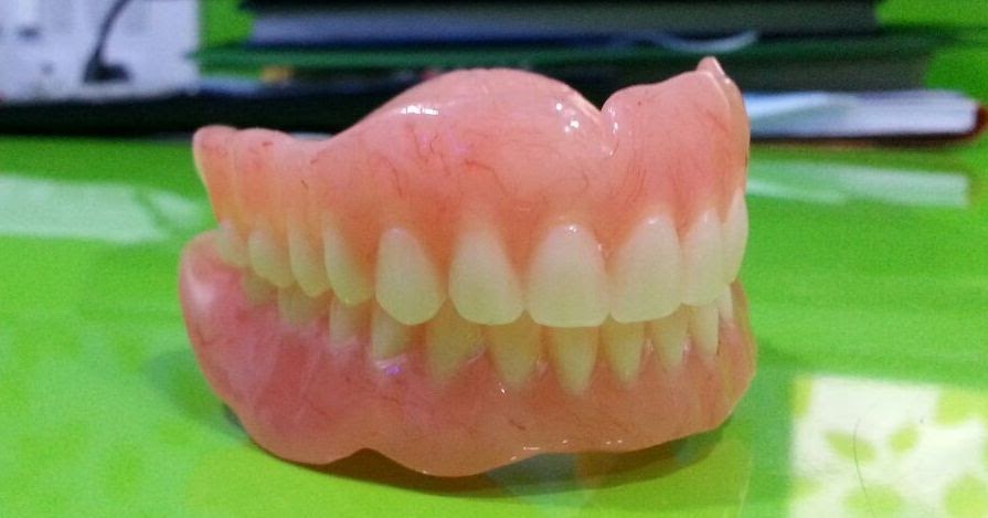 dentures denture insertion