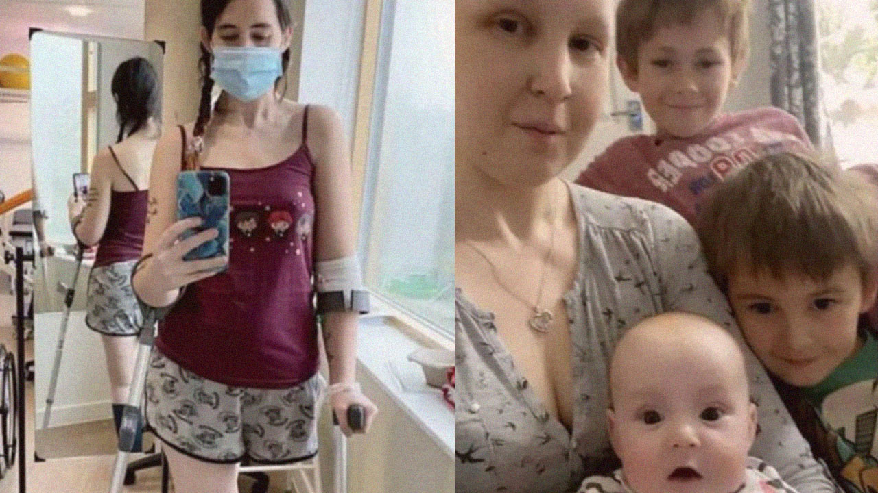 Para não abortar filha, mãe decide amputar perna após diagnóstico de câncer