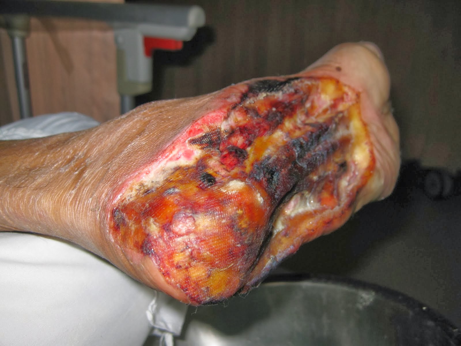 November 2013 DUNIA KEPERAWATAN