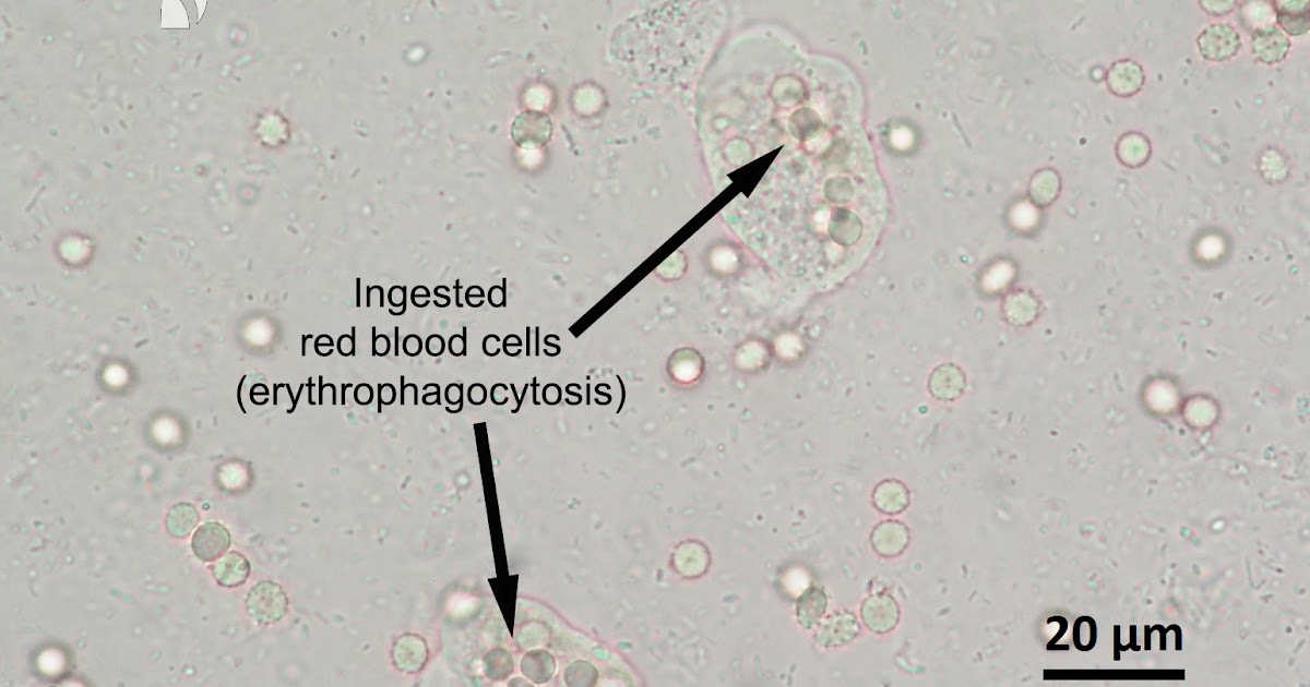 Entamoeba Histolytica Trophozoite Rbc