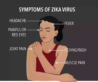 Kerala में Zika virus के मामले 3 नए मामलों के साथ 50 के पार