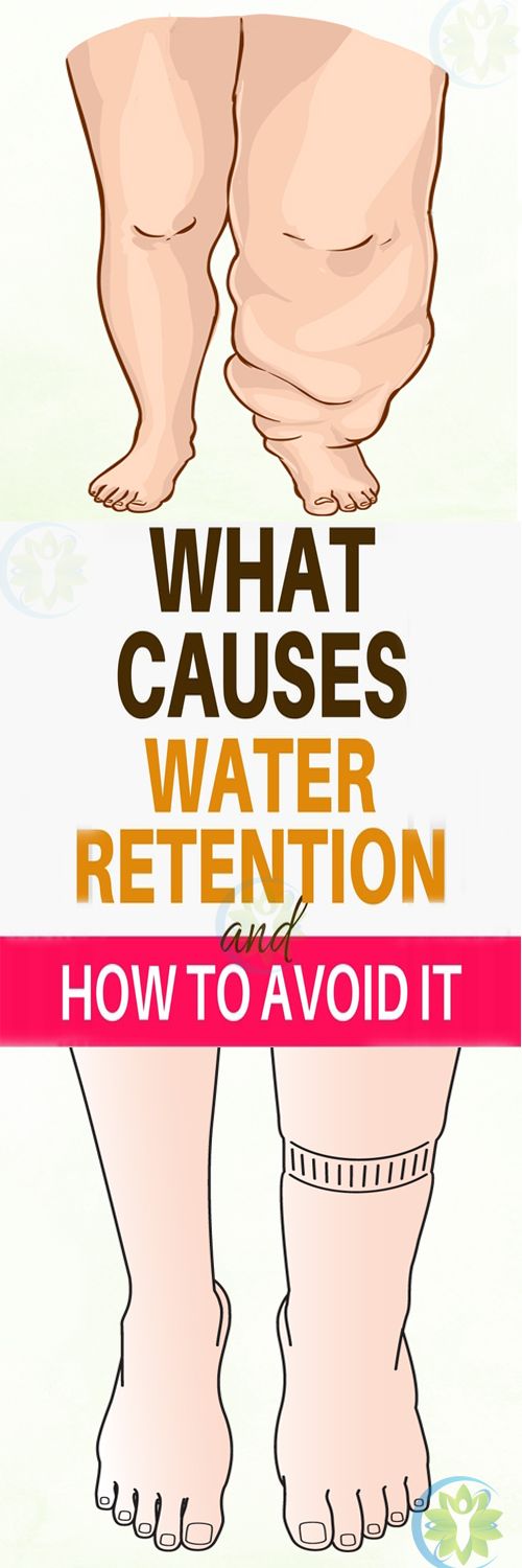 Simple Tricks to Avoid Water Retention Lizy Style