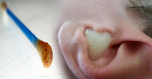 How To Properly Clean Unblock And Remove Your Ear Wax The