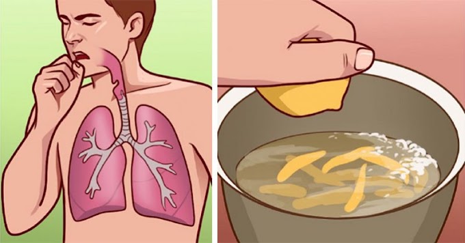 10 remedios caseros para ayudar con la bronquitis y los ataques de tos dolorosos