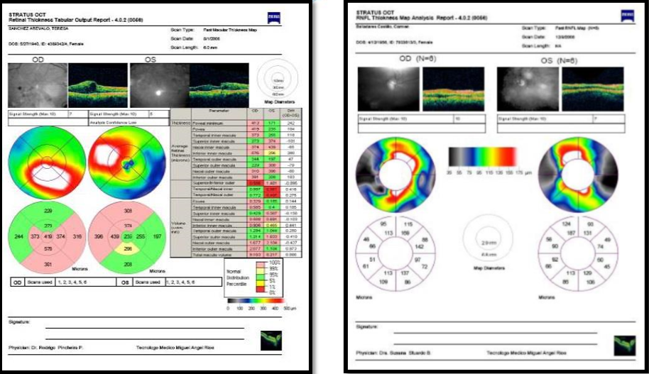 Cátedra N° 05 Imágenes de OCT e indicaciones de uso Cátedra N° 05 Imágenes de OCT e indicaciones de uso