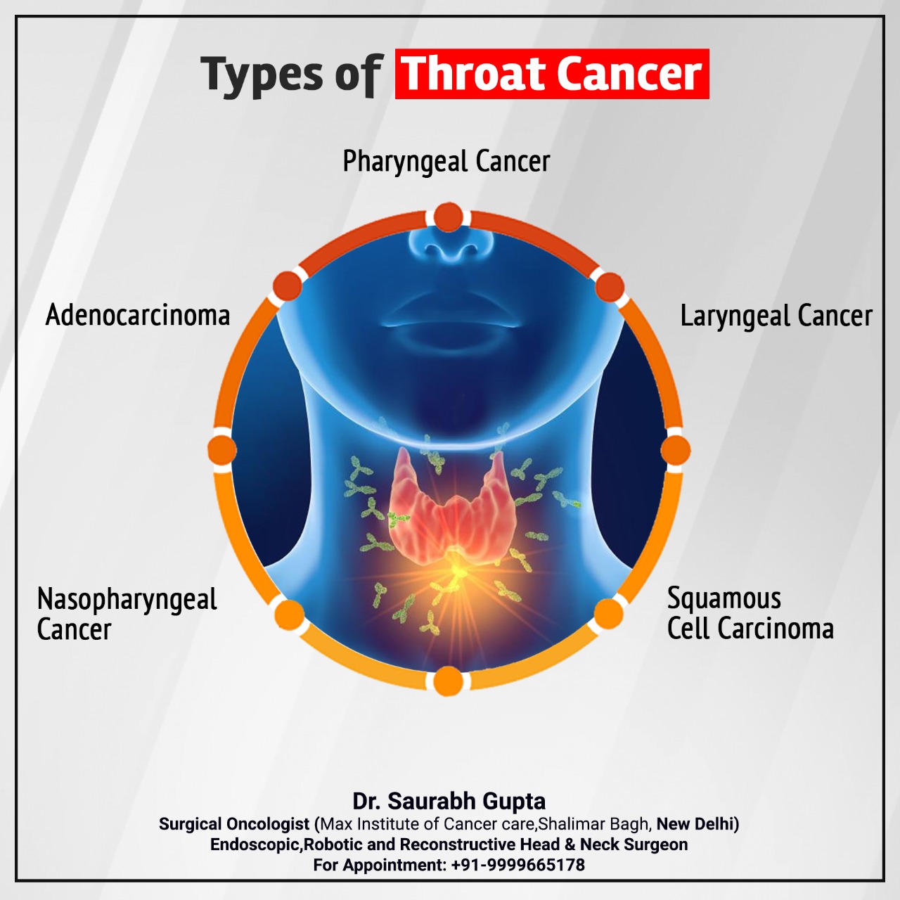 dr-saurabh-gupta-oncologist-types-of-throat-cancer