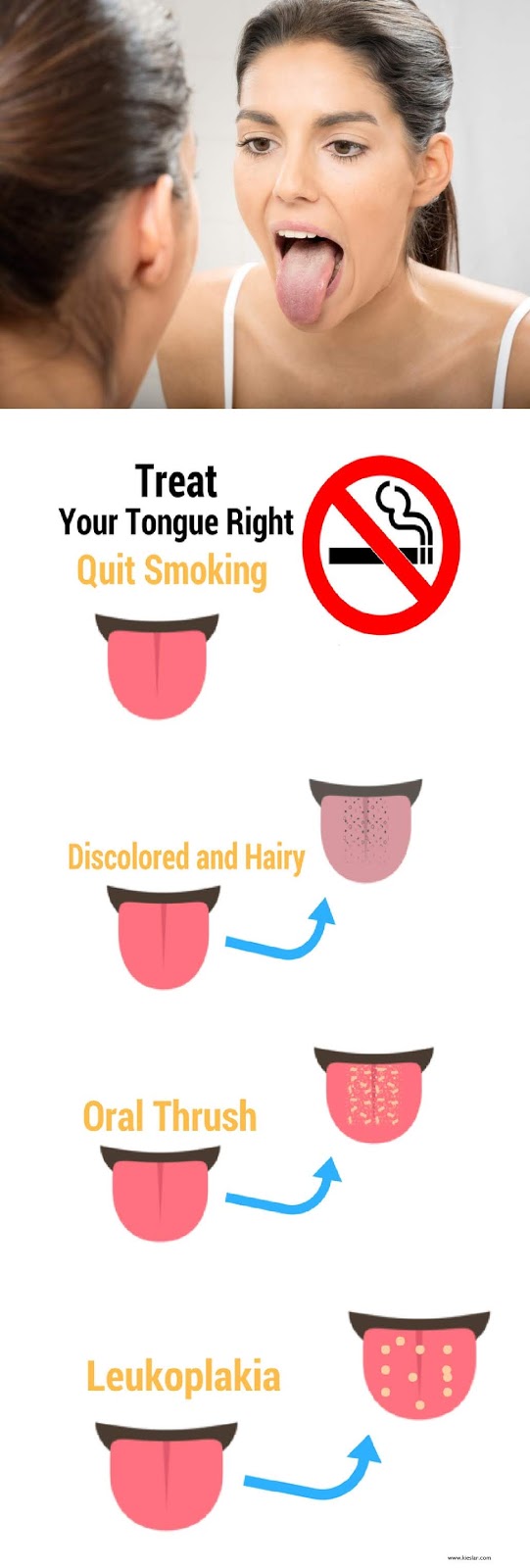 Best Remedies For Smokers To Treat Their Tongue RightQuit Smoking