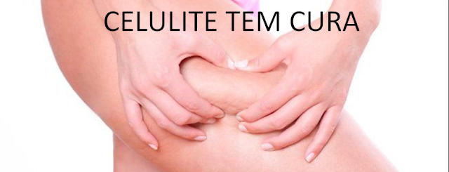  CELULITE TEM CURA