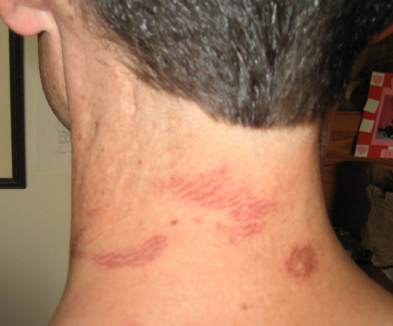 Julio Macias Gonzalez (17) Dies after his girlfriend gives him a hickey(04)