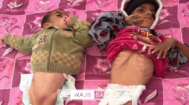 Semua Orang Akan Menangis Saat Melihat Potret Pilu Bocah Korban ISIS di Mosul, Sekarat Menjemput Maut Semua Orang Akan Menangis Saat Melihat Potret Pilu Bocah Korban ISIS di Mosul, Sekarat Menjemput Maut