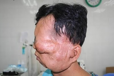 Penyakit Tumor Paling Mengerikan Di Seluruh Dunia | Tanggulangin Community
