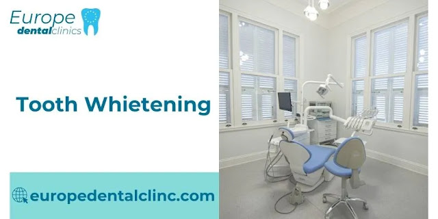 Tooth Whietening - Europe Dental Clinic