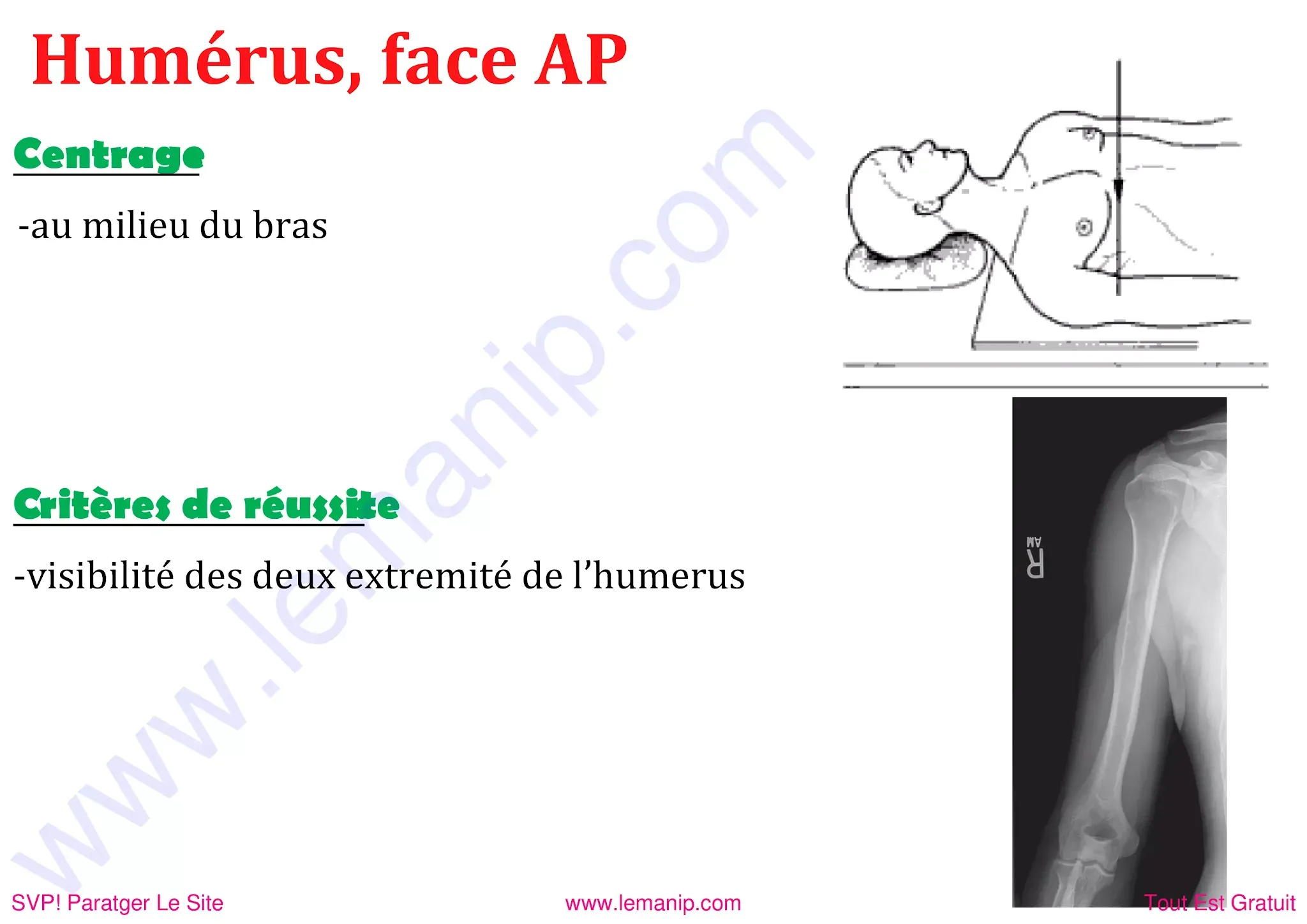 hUMERUS de face