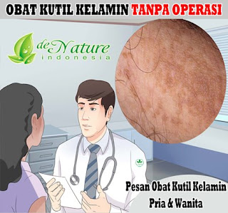 Obat tradisional kutil kelamin atau kutil di kemaluan pria, seperti kutil di kelamin, kutil kemaluan pada skrotum, obat kutil kemaluan, obat kutil kelamin khusus ibu hamil, obat penyakit kondiloma akuminata, kutil di kelamin laki2, obat tradisional kutil kelamin atau kutil di kemaluan ibu hamil, pengobatan kutil kelamin pada wanita, nama obat kutil kelamin atau kutil di kemaluan dari dokter, kutil selangkangan