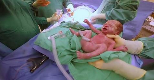 Une mère attendait des jumeaux normaux, mais lorsque les médecins lui ont montré cette photo, elle a eu le souffle coupé.