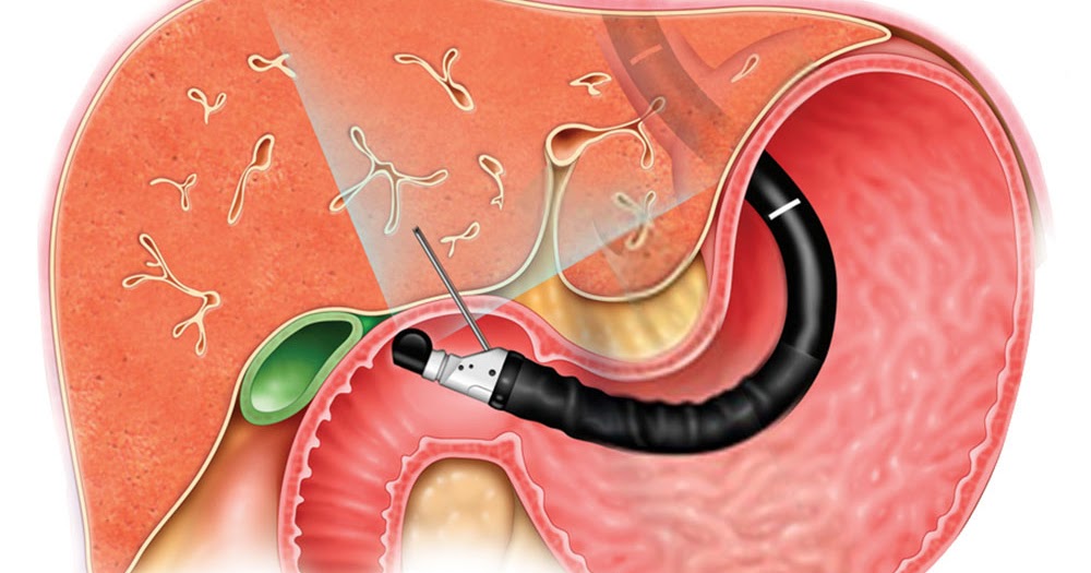 Dr. Gautam Tamboliya Top Gastroenterologist Doctor in Ahmedabad Best Endoscopy Ultrasound