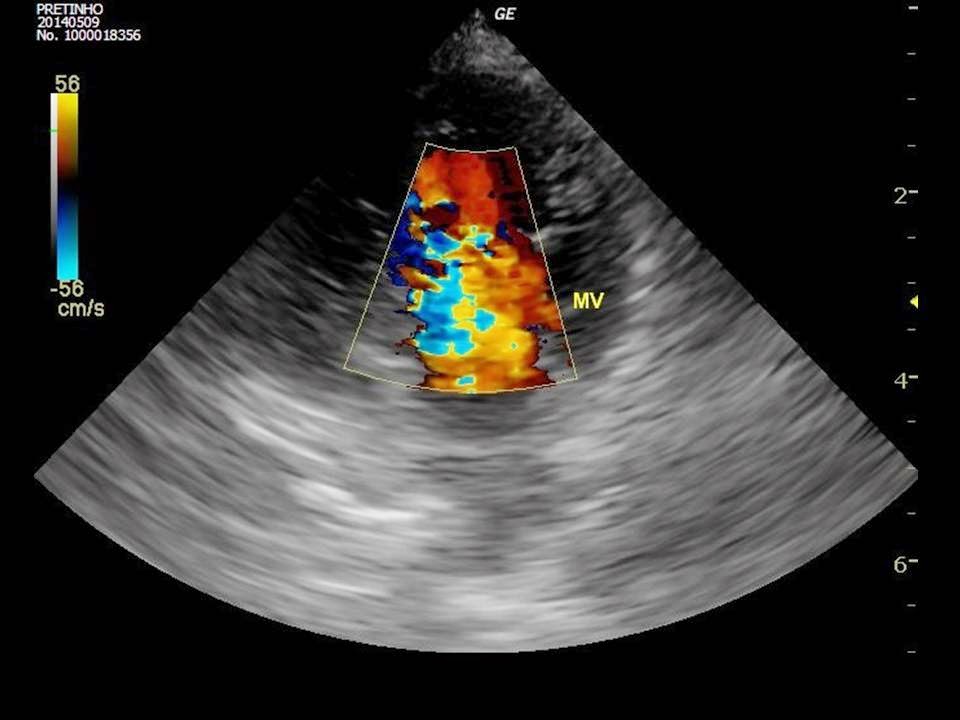 CRVImagem: Endocardiose