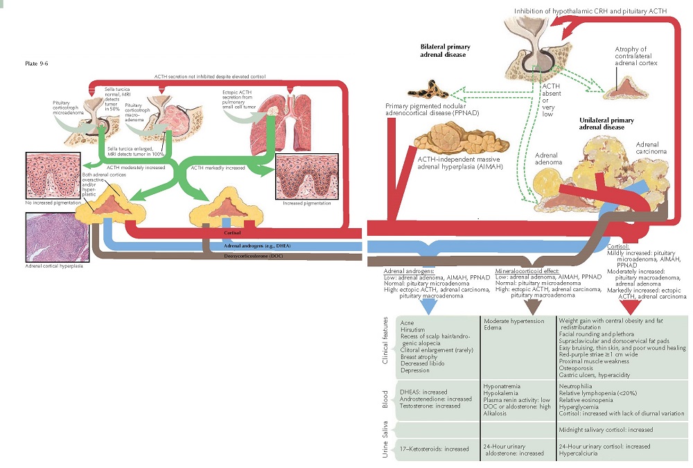 CUSHING’S SYNDROME PATHOPHYSIOLOGY pediagenosis