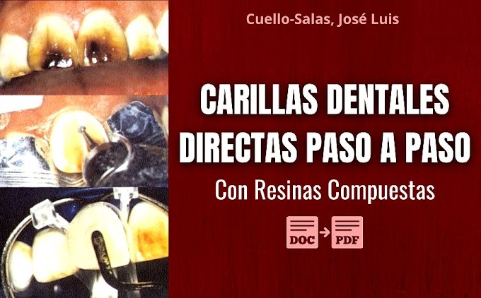 PDF: CARILLAS DENTALES DIRECTAS con Resinas Compuestas Paso a Paso - Cuello-Salas, José Luis