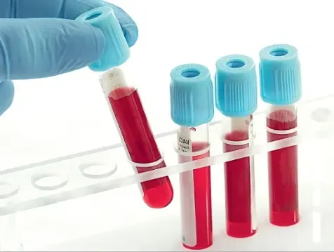 Overview of the VAP Blood Test Overview of the VAP Blood Test