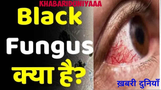 ब्लैक फंगस क्या है,  ब्लैक फंगस के कैसे बचे Black Fungus Kya Hai 
