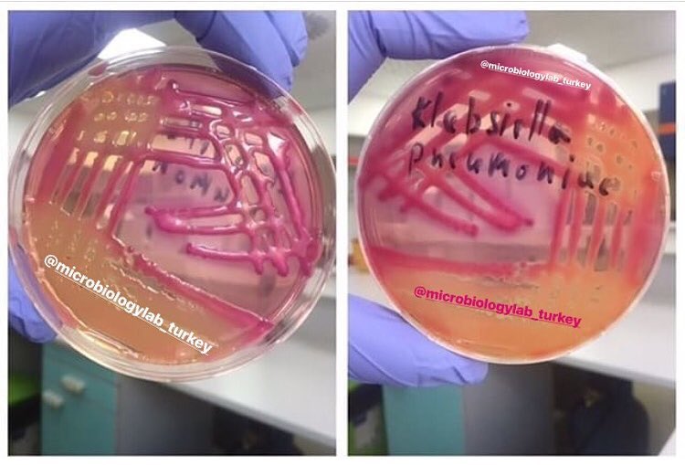KLEBSIELLA SPP. Microbiology Laboratory Turkey