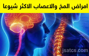 افضل دكتور مخ واعصاب في مستشفى الملك فيصل التخصصي عن تجربة