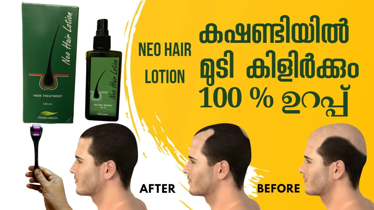 neo hair lotion,original neo hair lotion,neo hair lotion how to use,neo hair lotion fake,neo hair lotion result,neo hair lotion original and fake,ยาแก้หัวล้าน,สเปรย์ปลูกผม,นีโอแฮร์โลชั่น,หัวล้าน,ยาปลูกผม,neo hair lotion thailand,neo hair lotion side effect,neo hair lotion 2020,neo hair lotion feedback,neo hair lotion results,neo hair lotion side effects,hair growth oil,hair loss treatment,hair regrowth,neo hair lotion before after reviews,review neo hair lotion malayalam,neo hair lotion review,neo hair lotion tamil,neo hair lotion results,neo hair lotion in telugu,neo hair lotion original and fake,neo hair lotion price,neo hair lotion malayalam review,neo hair lotion and derma roller,neo hair lotion after hair transplant,neo hair lotion arabic,neo hair lotion amharic,neo hair lotion available in qatar,neo hair lotion abu dhabi,neo hair lotion available in saudi arabia,നിയോ ഹെയർ ലോഷൻ,മുടി വളരാൻ നിയോ നിയോ ഹെയർ ലോഷൻ,മുടി വളരാൻ നിയോ,neo hair lotion are there any possible side effects | neo hair lotion ദോഷഫലങ്ങൾ 🤔 ?,#neo_hair_lotion_ kuwait,#how_to_get_rid_of_baldness,#how_to_grow_hair\quickly_on_the_head,#original_neo_hair_lotion,#how_to_use_original_neo_hair_lotion,#original_neo_hair_lotion_median_thailand,#how_to_stop_hair_loss_in_women,#remedy_for_hair_loss_in_women,#neo_hair_lotion_malayalam,original_neo_hair_lotion_thailand,tail and orgnal മുടി കൊഴിച്ചിൽ,മുടി കൊഴിച്ചിൽ മാറാൻ,മുടി കൊഴിച്ചിൽ തടയാൻ,മുടി കൊഴിച്ചിൽ തടയാം,മുടി,മുടി കൊഴിച്ചിൽ എങ്ങനെ തടയാം,മുടി കൊഴിച്ചിൽ മാറി മുടി തഴച്ചു വളരാൻ കാച്ചിയ എണ്ണ,മുടി വളരാൻ,മുടി കൊഴിച്ചില്‍,കൊഴിച്ചിൽ,മുടി തഴച്ചു വളരാൻ,മുടി തഴച്ചു,മുടിനര,മുടികൊഴിച്ചിൽ,മുടി വളരാന്‍,ചെമ്പരത്തി ഇല മുടി വളരാൻ,മുടി കൊഴിച്ചിൽ മാറി മുടി തഴച്ചു വളരാൻ കാച്ചിയ എണ്ണ/homemade hair oil for hair growth/super hair oil.,ഉള്ളുള്ള മുടിക്ക്,#കാച്ചിയ വെളിച്ചെണ്ണ,കാച്ചിയ എണ്ണ,ശ്രദ്ധിച്ചാൽ