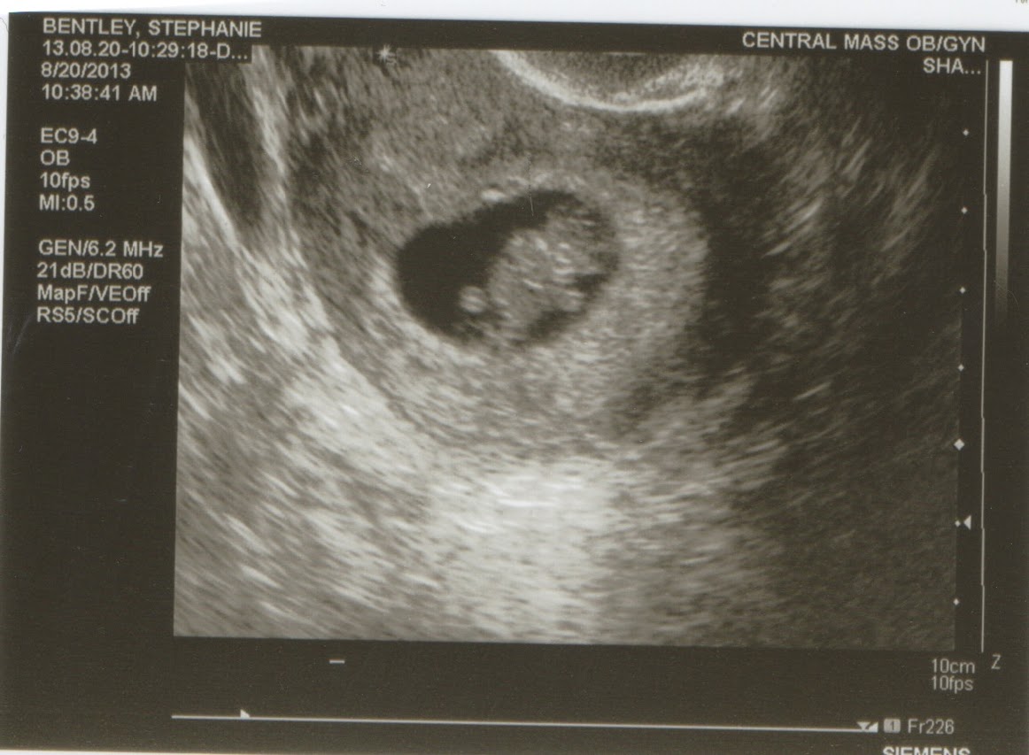 ultrasound teddy bear